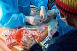 Đội điều trị Bệnh viện Đa khoa tỉnh Gia Lai ứng cứu thành công ca đẻ rơi