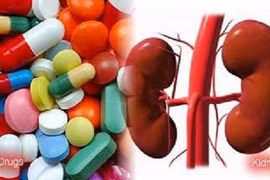 Điều gì xảy ra nếu bạn thường xuyên uống thuốc giảm đau?