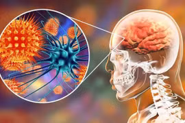 Cảnh báo một loại virus gây chết người gấp 75 lần virus Corona