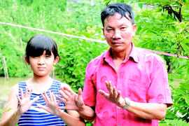 Bí ẩn gia tộc "dị ngón"