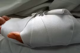 Một phụ nữ bị chém gần đứt lìa bàn tay trong tiệm game Rồng Vàng