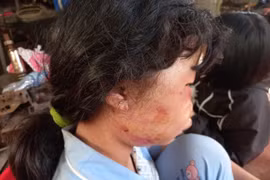 Bắt kẻ đánh đập nữ sinh lớp 6 trong lô cao su