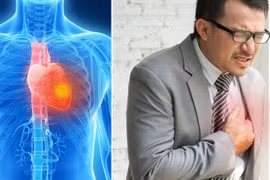 Phát hiện mới: Ngày nào người ta hay bị đau tim hơn?