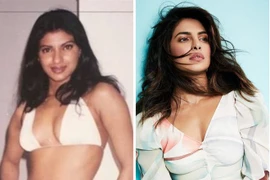 Hoa hậu Thế giới Priyanka Chopra gây sốc với ảnh thời chưa 'dao kéo'