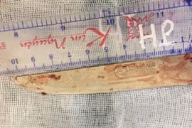 Cứu bệnh nhân bị dao đâm thủng gan