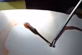 Bé trai 3 tuổi bị đỉa chui vào mũi sống ký sinh