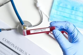 Bệnh nhân COVID-19 người Nhật khỏi bệnh 2 tuần, xét nghiệm lại 2 lần đều dương tính