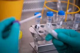 Mới: Phát hiện thay đổi trong triệu chứng lâm sàng của virus corona