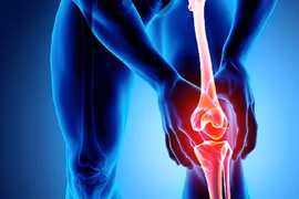 Những người bị đau đầu gối cần lưu ý gì khi chơi thể thao?