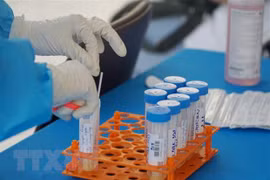 Trưa 4/7, ghi nhận thêm 260 ca mắc COVID-19, riêng TP.HCM có 213 ca