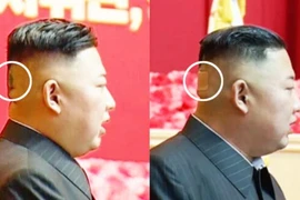 Ông Kim Jong-un bất ngờ xuất hiện với băng dán sau đầu