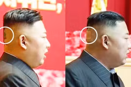 Ông Kim Jong-un bất ngờ xuất hiện với băng dán sau đầu