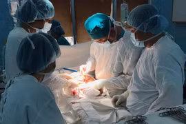 Cắt khối u buồng trứng nặng đến 35 kg