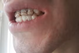 Thầy giáo trẻ mòn dần lưỡi vì thức uống 'vạn người mê'