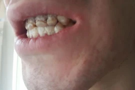 Thầy giáo trẻ mòn dần lưỡi vì thức uống 'vạn người mê'