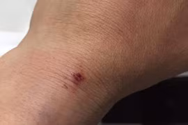 Truy tìm 2 kẻ côn đồ chặn đường,tấn công chủ tịch phường ở Đắk Lắk