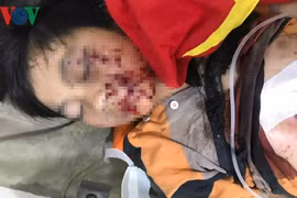 Vừa chơi game vừa sạc pin điện thoại, 1 cháu bé suýt mất mạng