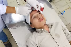 Nhóm côn đồ cầm dao vào trạm kiểm lâm Cù Đinh đánh một kiểm lâm nhập viện