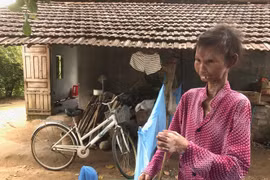 Nàng sơn nữ biến thành bà già vì bệnh lạ