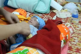 Cứu sống bé gái sinh non có nội tạng nằm ngoài ổ bụng