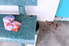 Điều tra nghi án nam thanh niên đâm bạn gái rồi tự sát