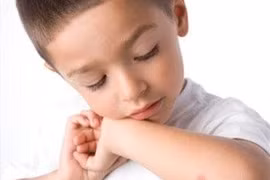 Đừng xem nhẹ vết lõm trên da