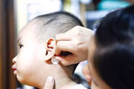 Cảnh báo miếng dán chống say tàu xe có thể gây loạn thần ở trẻ