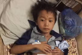 Cậu bé 10 tuổi bị trâu húc vỡ ruột non