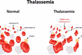 Em bé đầu tiên được lọc gene bệnh tan máu khi thụ tinh trong ống nghiệm là người Gia Lai