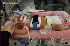 Nụ hôn của người lớn có thể 'giết chết' trẻ sơ sinh