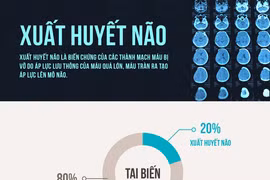 Xuất huyết não khởi điểm từ đâu?