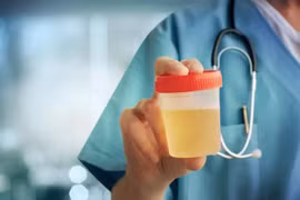 Phương pháp xét nghiệm nước tiểu mới cho biết chế độ ăn tốt nhất cho từng người