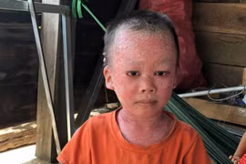 Nghèo nên không có tiền chữa bệnh cho con