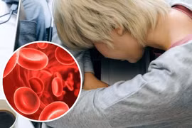 Cơ thể thiếu sắt có thể gây nên những bệnh gì?