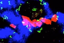 Phát hiện đột phá: Cơ chế giúp bệnh ung thư tự "ngủ đông"