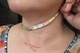 "Nghịch tử" 49 tuổi giật dây chuyền vàng mẹ ruột 85 tuổi đang tắm