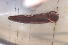 Con đỉa sống 3 tháng trong mũi người đàn ông