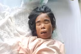 Tìm người thân của bệnh nhân Nhui đang điều trị tại Bệnh viện Đa khoa tỉnh Gia Lai