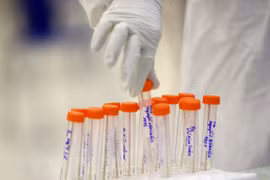 Người đã mắc biến thể BA.1, BA.2 vẫn có thể mắc lại BA.4, BA.5