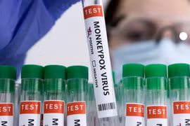 Triệu chứng của bệnh đậu mùa khỉ, điều trị và phòng ngừa