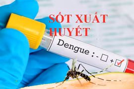 Ia Pa: Số ca sốt xuất huyết tăng, toàn huyện có 31 ổ dịch