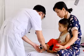 Gia Lai: Bệnh tay chân miệng tăng 11,4% so với cùng kỳ năm 2021