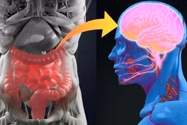 Bệnh Parkinson có thể bắt nguồn từ ruột thừa
