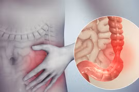 Mật heo và những bài thuốc chữa bệnh hiệu quả từ mật heo ít người biết