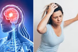 Cảnh báo bệnh đột quỵ ngày càng trẻ hóa