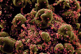 Phát hiện sinh vật đầu tiên trên thế giới chỉ ăn virus để sống