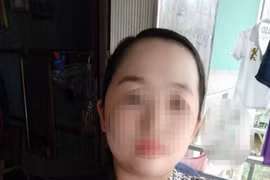 "Bão mẫu" dùng tay đánh vào đầu bé trai tổn thương não 99%