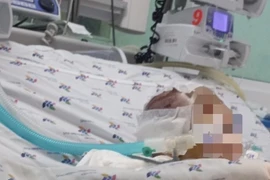 Bắt khẩn cấp "bảo mẫu" bạo hành khiến bé 6 tháng tuổi bị dập não