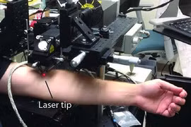 Mỹ tìm ra công nghệ mới phát hiện sớm tế bào ung thư