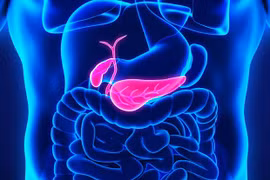 Đột phá mới trong nghiên cứu điều trị ung thư tuyến tụy di căn